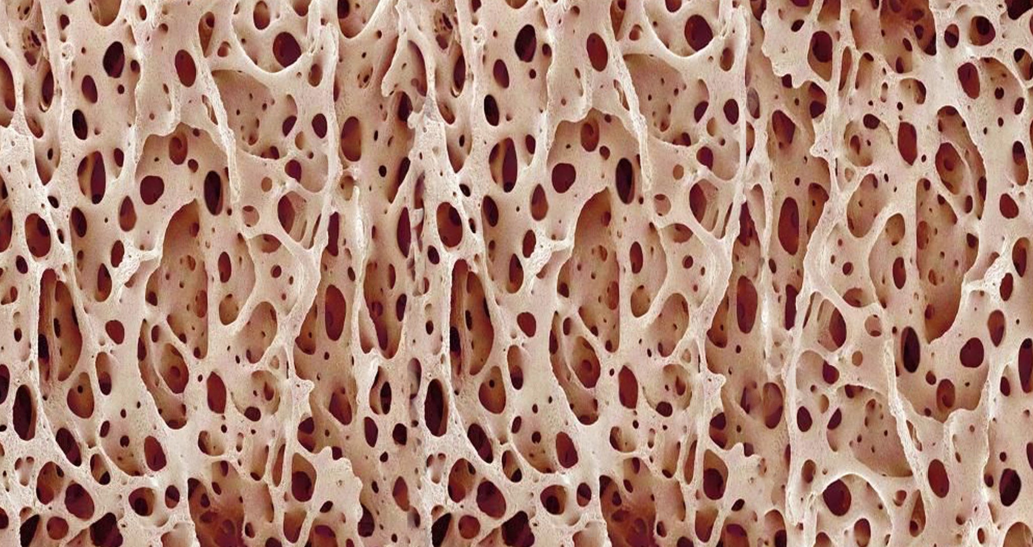 Collagen and Bone Health